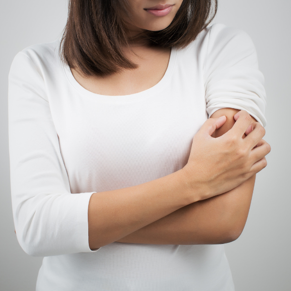 Itch Balm